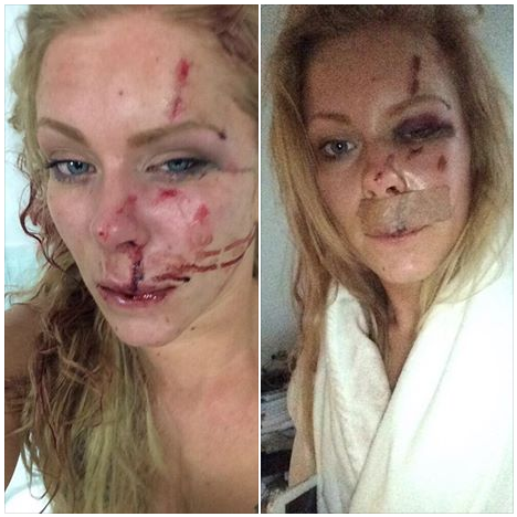 danish woman beaten up 27.12.2014